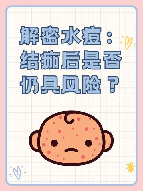 水痘康复后是否能进行试管婴儿治疗？