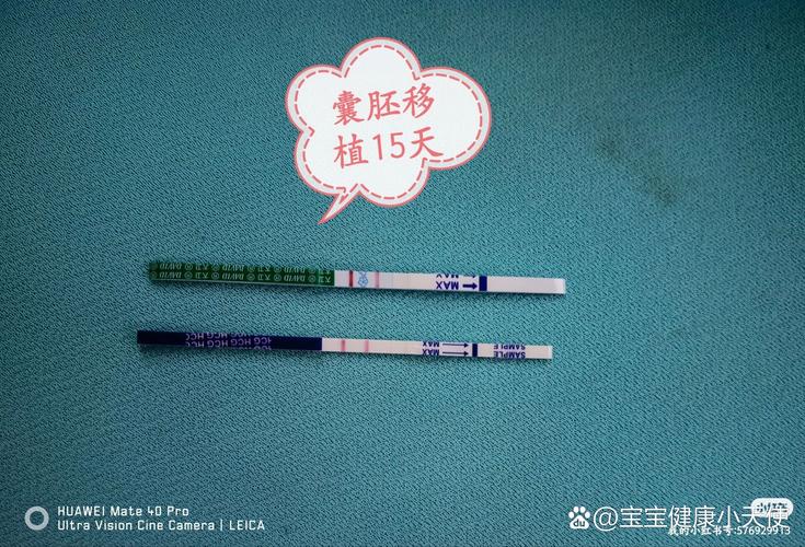 移植15天出血