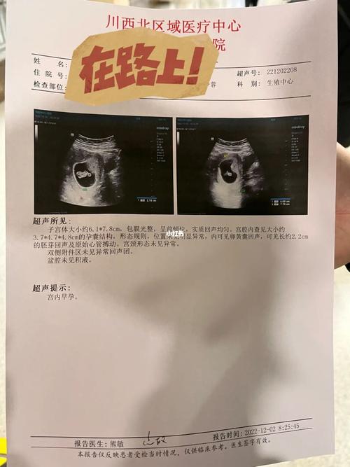 移植八周