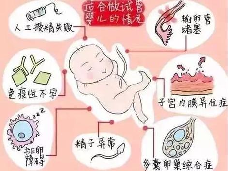 试管婴儿后为何出现下垂痛？解析原因与解决方案