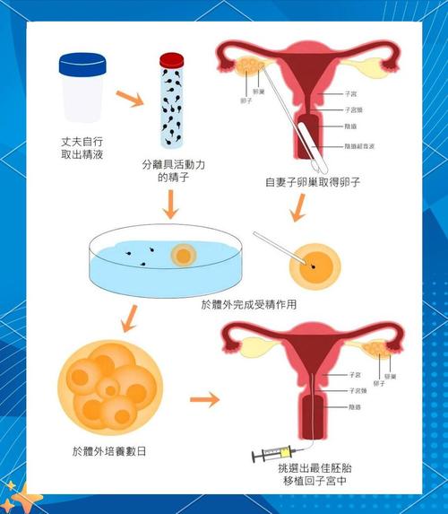 如何在韩国进行试管婴儿的性别选择？