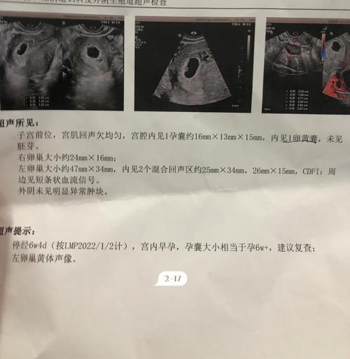 胎心缓慢