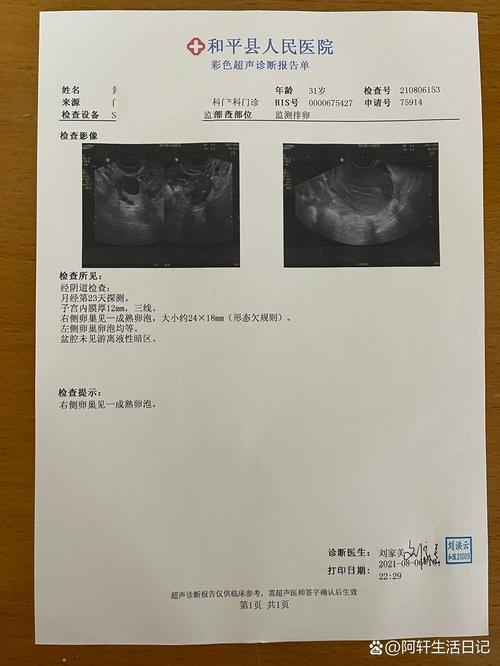 卵泡成熟检查