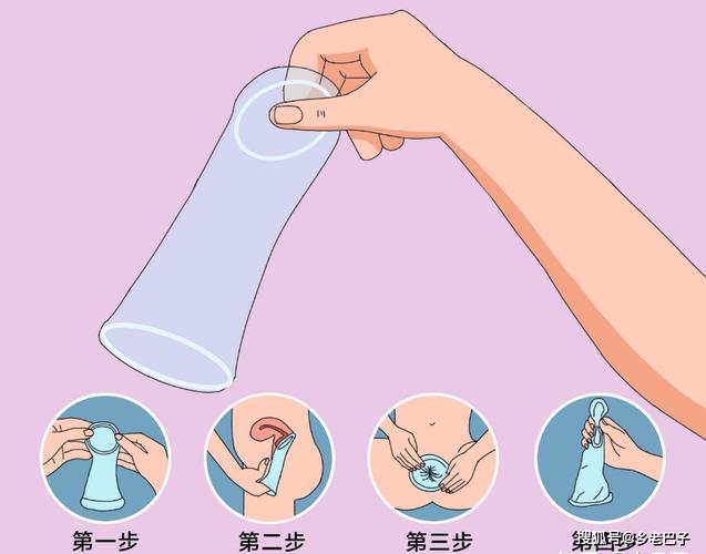  避孕方法