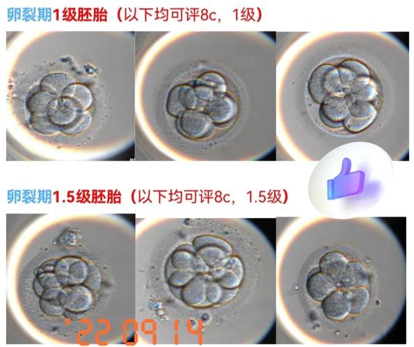 胚胎B级移植