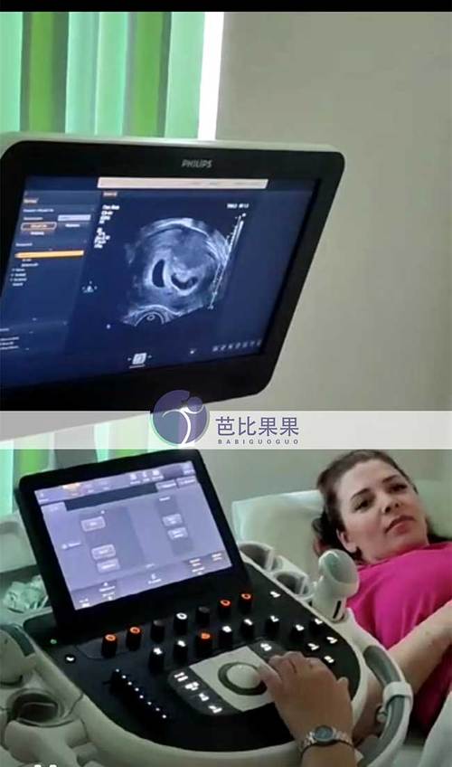 试管婴儿过程中b超检测疼吗？详细解析与建议