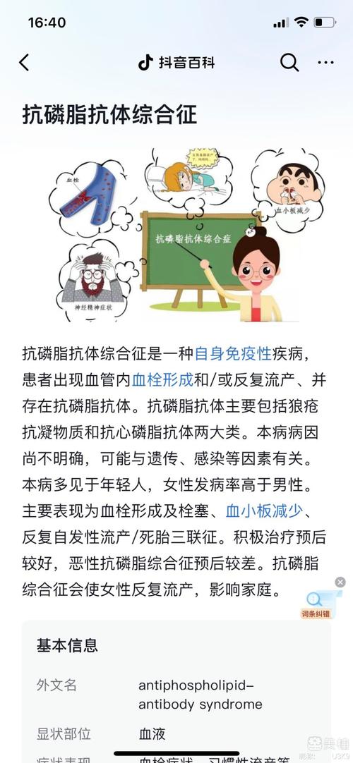  抗磷脂抗体综合征