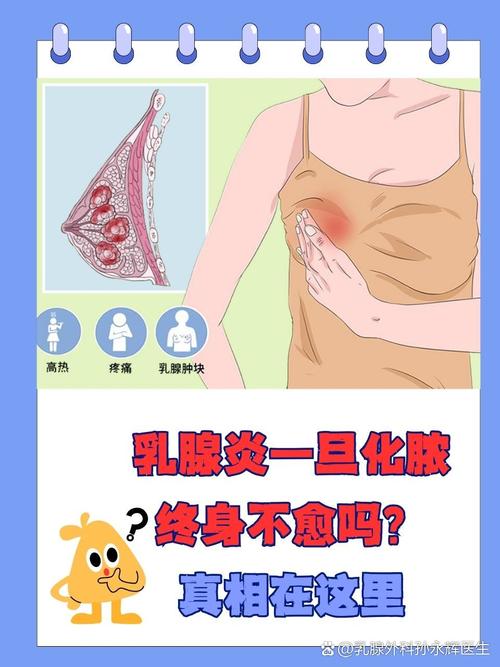 乳腺炎患者是否适合进行试管婴儿治疗?