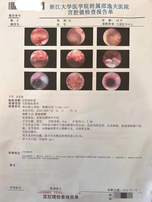 试管前宫腔镜检查费用大概是多少？