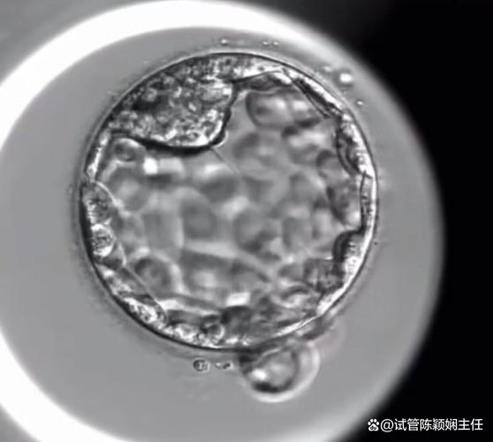 试管胚囊