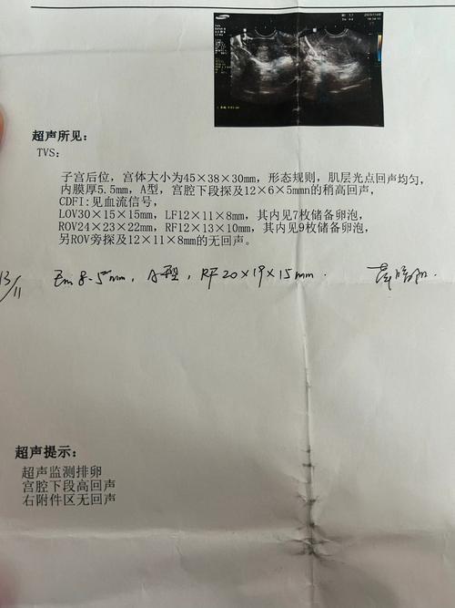 高回声