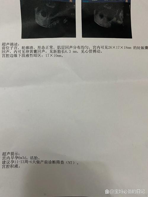 移植后24天