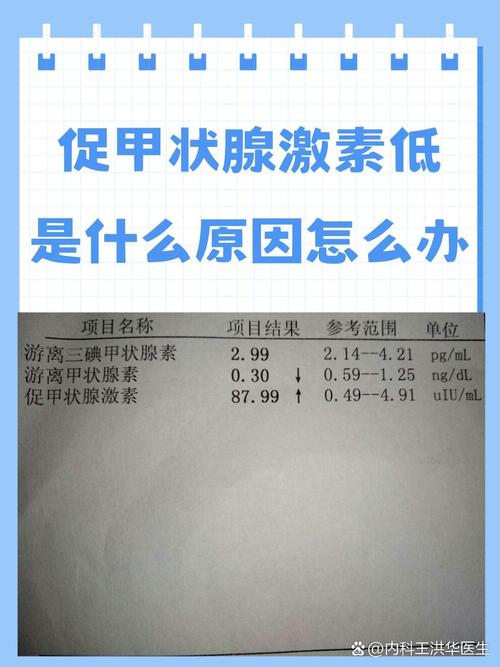 促甲状腺素
