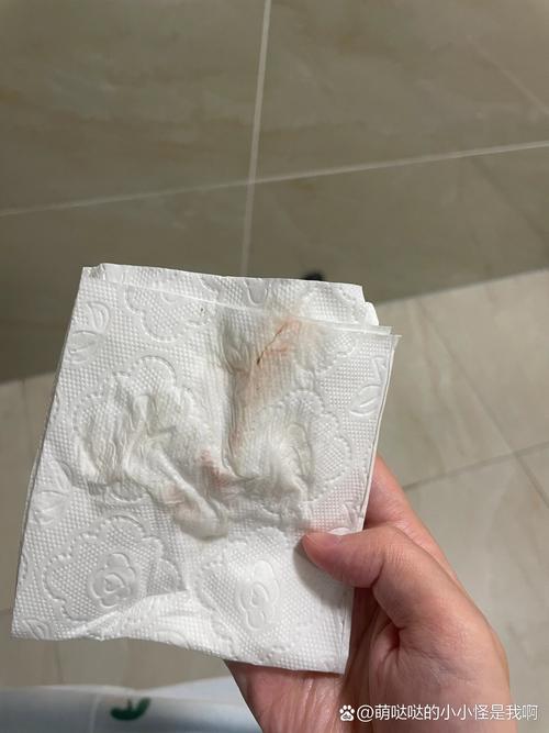 移植前出血