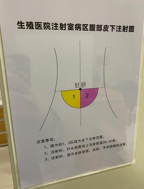 促排第一天
