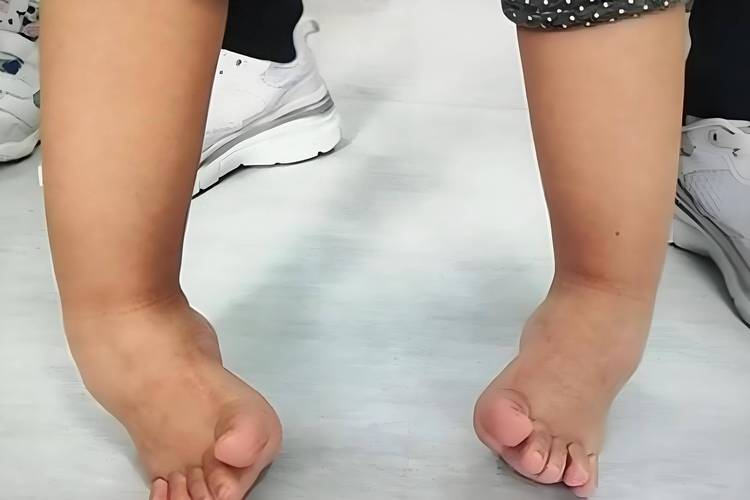 试管婴儿后能否安全食用笋？专家给出详细解答