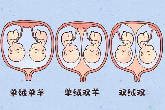 双胎可能性