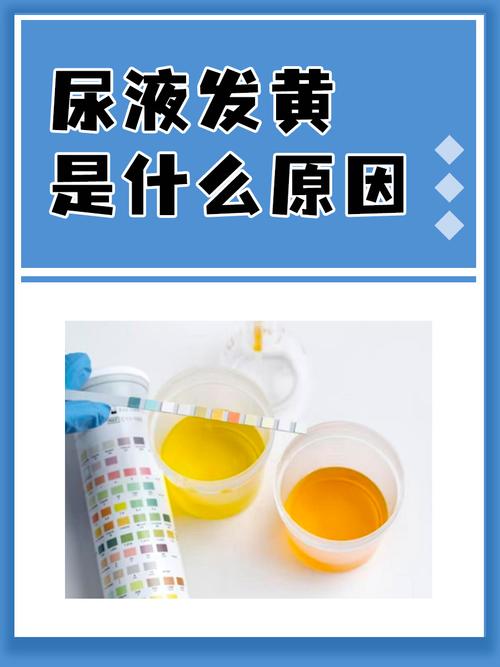 尿黄原因