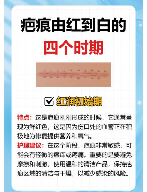 疤痕形成