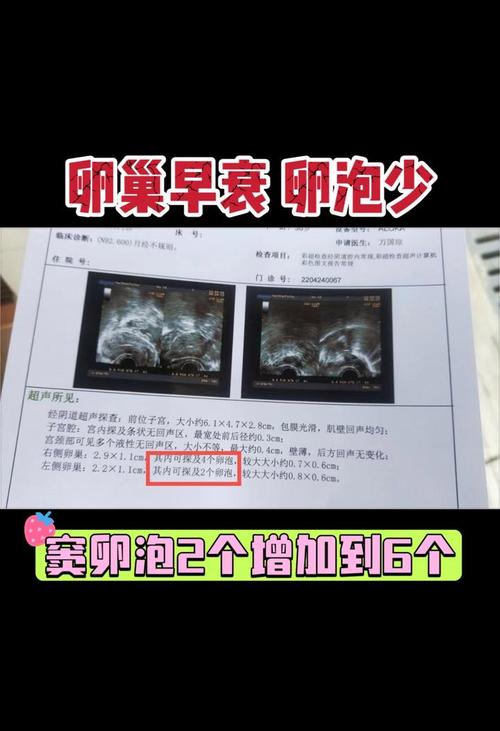 卵泡减少