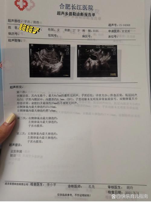 卵泡增大