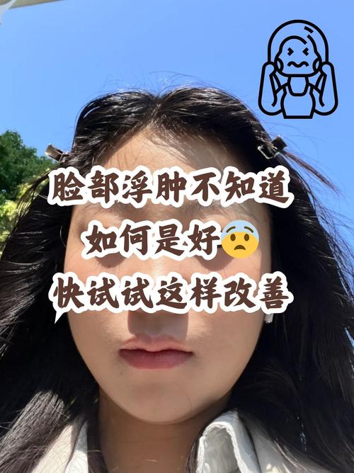 脸部水肿