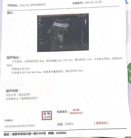 移植40天
