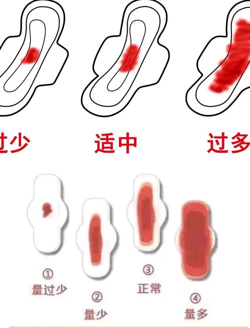  月经量少