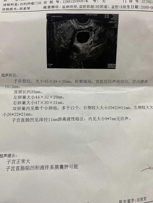 卵泡未排出
