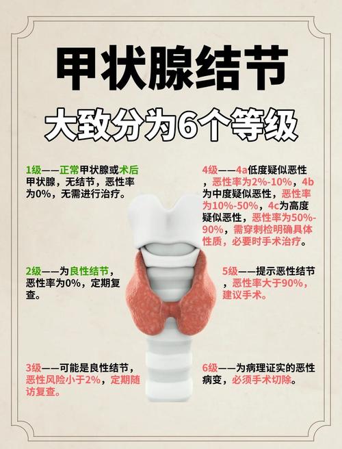 甲状腺结节