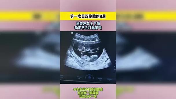 第一次B超