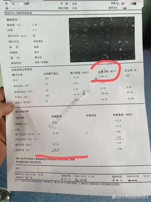 精子数量少