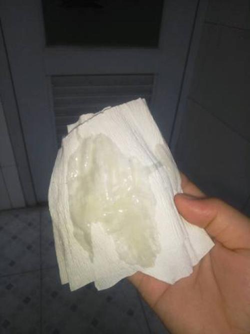  破水