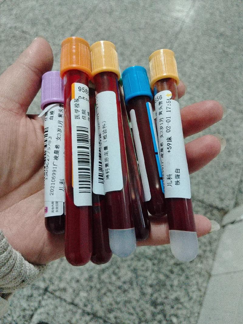 抽血试管