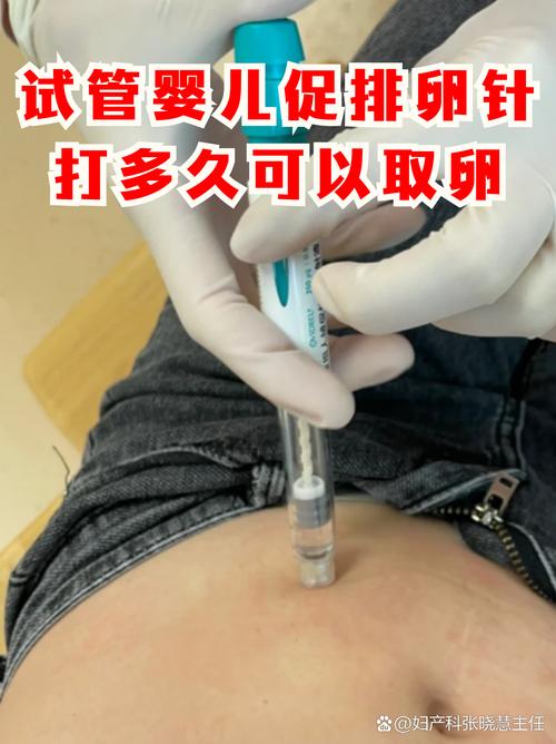 打针促排卵
