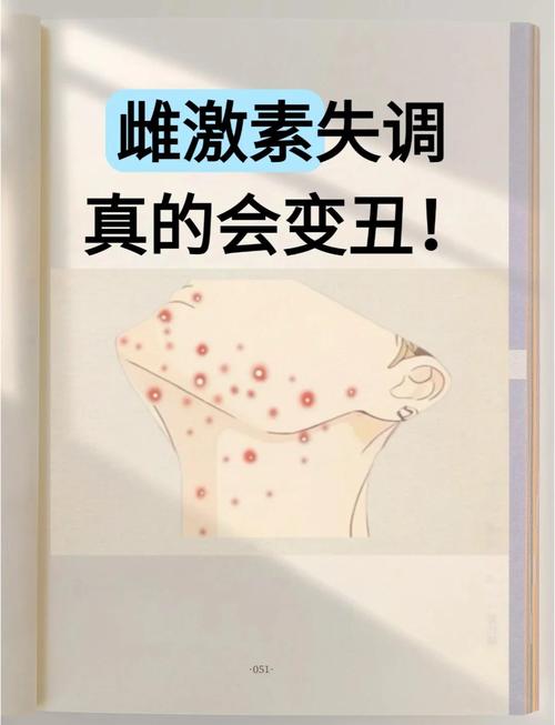 激素失调