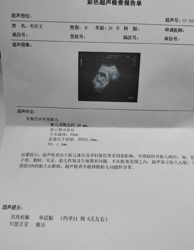 怀孕30天