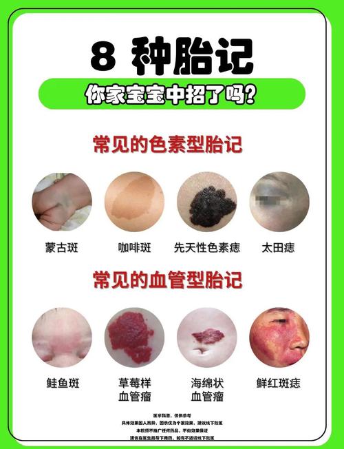 胚胎斑点