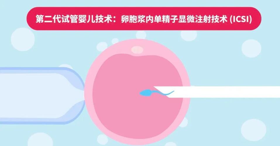 二代胚胎技术