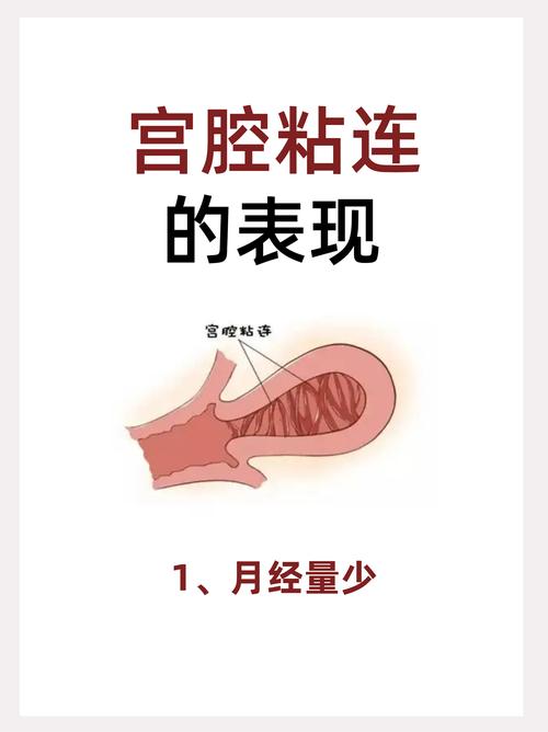  轻中度粘连