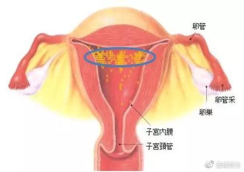 移植位置选择