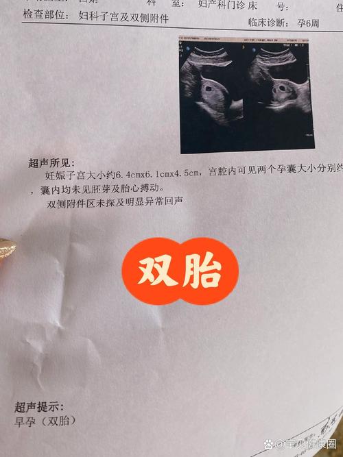 两个孕囊