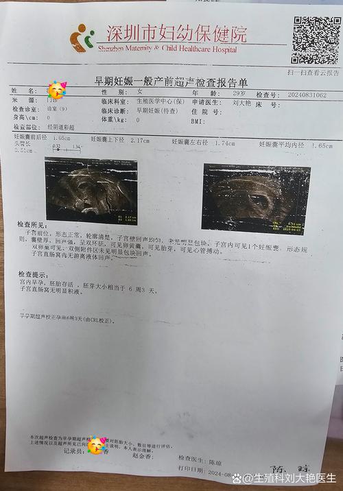 单胚胎