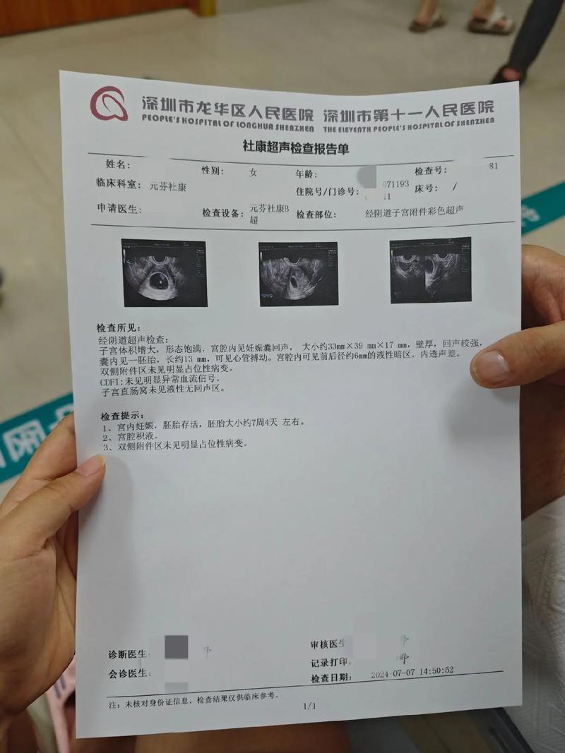 妊娠结果