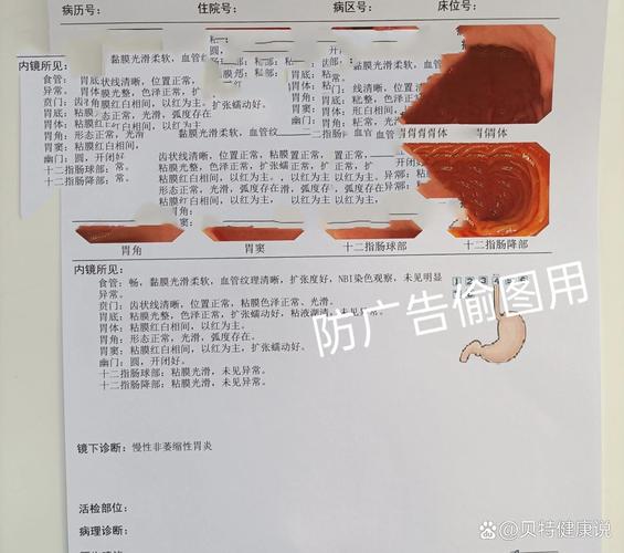 正常结果