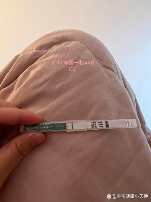 移植第二天
