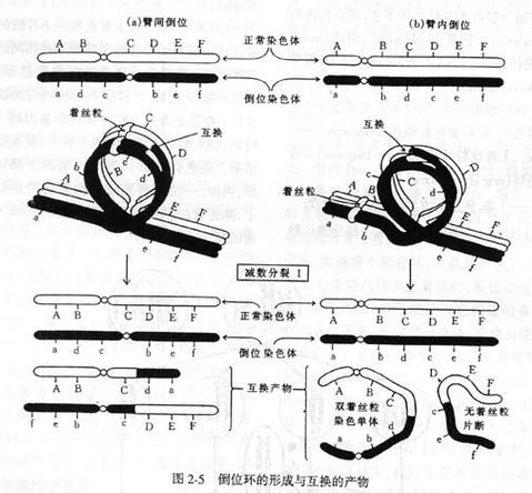 染色体臂间倒位