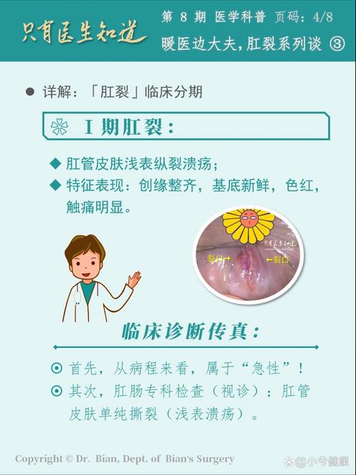 肛裂