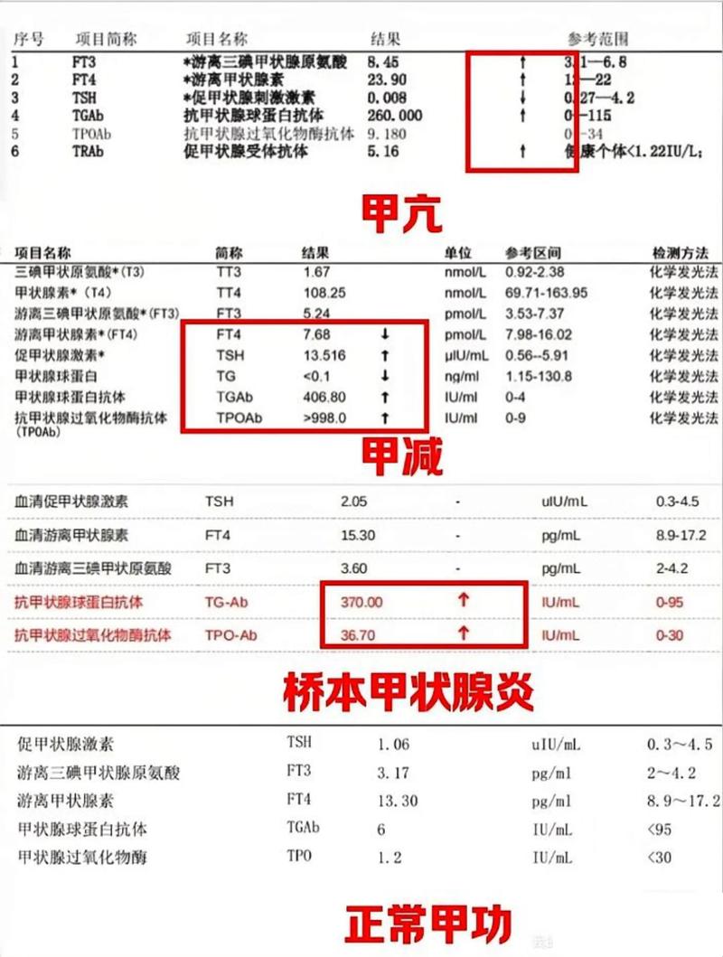  甲状腺检查
