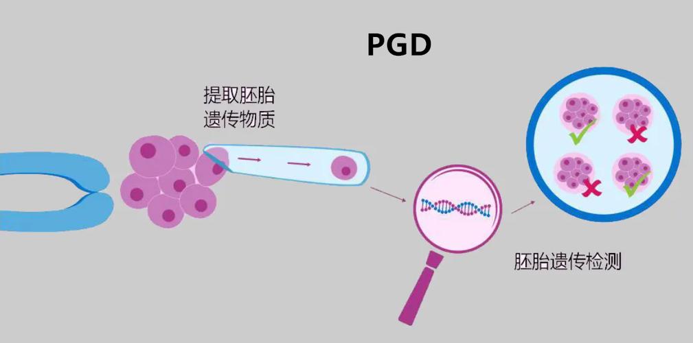 PGS筛查